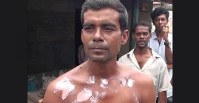 তিন ভাইকে ঝলসে দেওয়ায় ছাত্রলীগ নেতা বহিষ্কার