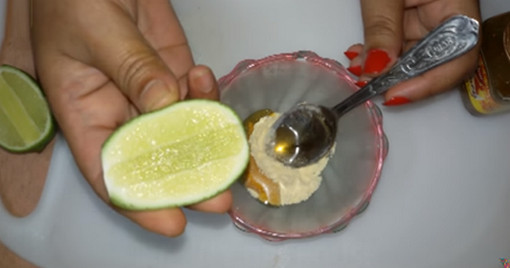 মুখের কালো দাগ ও ত্বকের মেছতার দাগ চিরতরে দূর করুন,নিয়মাবলী জেনে নিন।।(ভিডিও সহ)