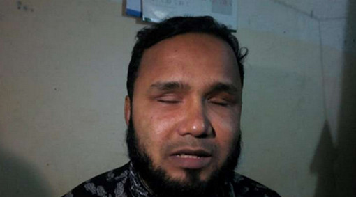 তবুও দুঃখ ঘুচল না চোখ হারানো সিদ্দিকুরের