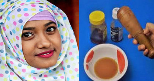 পুরুষাঙ্গের আগা মোটা গোরা চিকন হলে করনীয় কি ? এর সমাধান- ঘরোয়া ট্রিটমেন্ট দেখে নিন ভিডিওতে