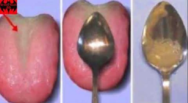 চামচই বলে দেবে কিডনি বা ফুসফুসের রোগ আছে কিনা..?