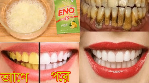 মাত্র ১০ মিনিটে কালো এবং হলুদ দাত মুক্তোর মতো সাদা করুন, যা ১০০% কার্যকারী