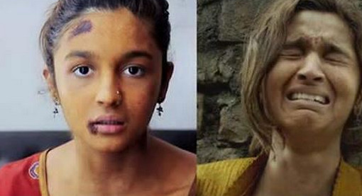 আলিয়া ভাট গুরুতর আহত, বন্ধ শ্যুটিং