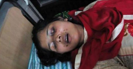 সৎ মায়ের সঙ্গে আপত্তিকর অবস্থায় দেখে ফেলায় স্ত্রীকে অন্ধ করে দিল স্বামী