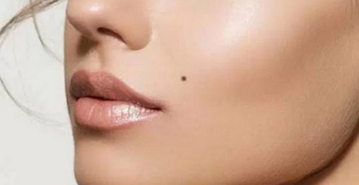 মুখের ঠিক কোন জায়গায় তিল থাকলে কী হয়? মিলিয়ে নিন ফলাফল