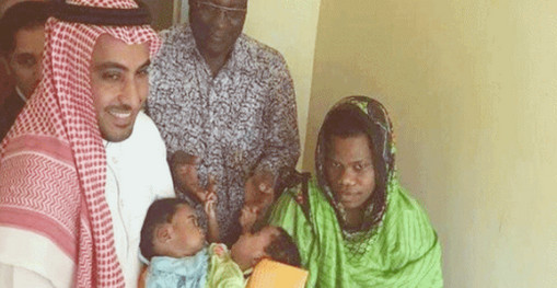 সৌদি আরবের প্রতিশ্রুতি তানজানিয়ার জোড়া লাগা শিশুর চিকিৎসার যাবতীয় খরচ বহন করবে