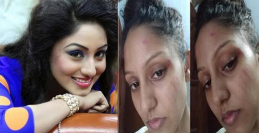 পরকীয়া প্রেমে মারধরের শিকার চিত্রনায়িকা রাকা