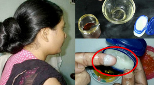 গোপনাঙ্গে যা মেখে পুরুষাঙ্গ ঢুকালে সহজে পতন হয় না, মেয়েরাও বেশি আরাম পায়-দেখুন কি সেই জিনিস