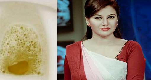 প্রস্রাবে ফেনা হতে পারে ভয়ানক রোগের লক্ষণ! (কেউ এরিয়ে যাবেন না)